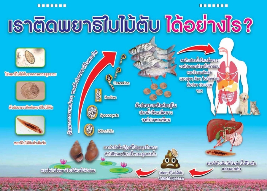 การป้องกันควบคุมโรคพยาธิใบไม้ตับ (Opisthorchiasis)